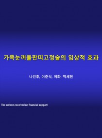 가쪽눈꺼풀판띠고정술의 임상적 효과 표지